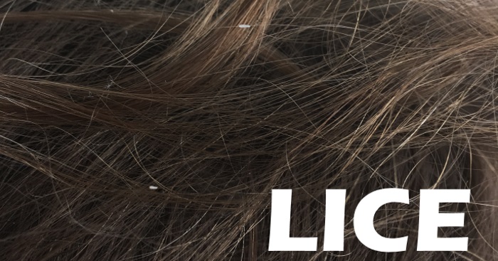 You’ve Got Lice! 13 Tips for Getting Rid of It