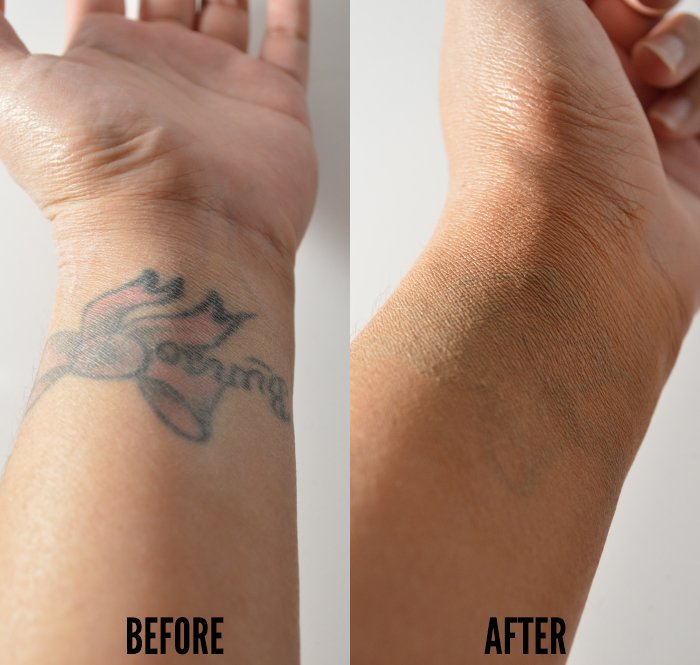 Cover-up tattoos: how they work and what to look