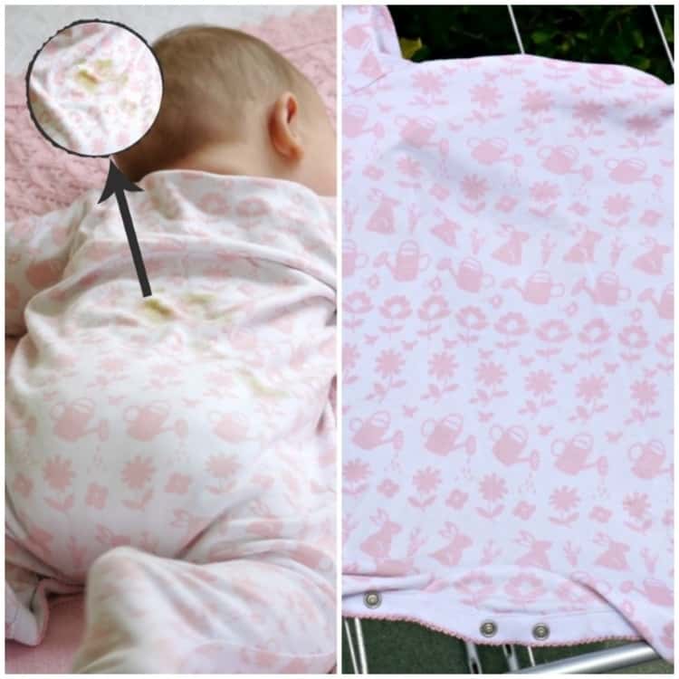 2-photo collage of a baby lying on his tummy with a magnified lens showing a soiled spot on the back of his onesie and a clean onesie hung out to dry.