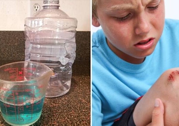 mouthwash hacks that don't include mouth feature collage of 2 photos